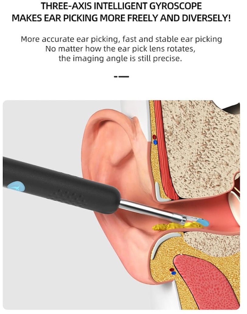 odstranjevalec ušesnega masla s kamero za čiščenje ušes