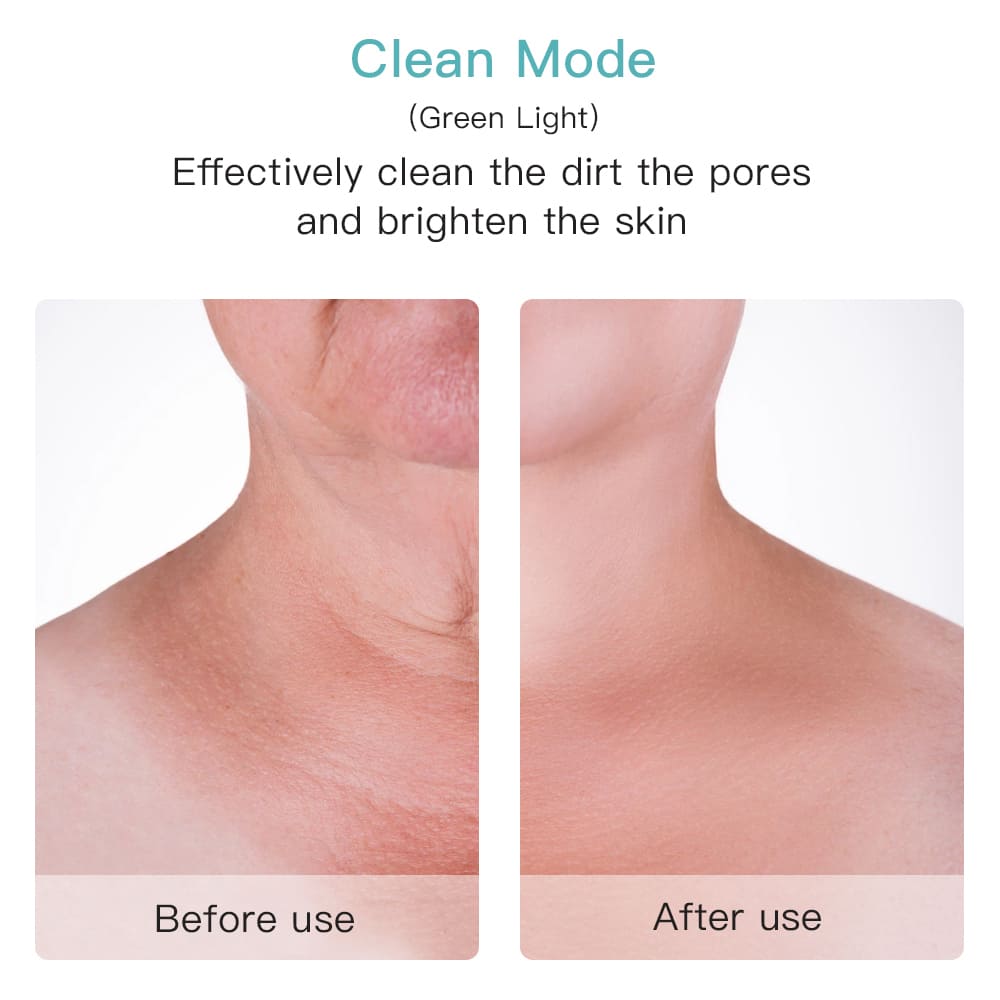Učinkovit čistilec por na obrazu vratu prej potem